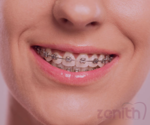Orthodontie